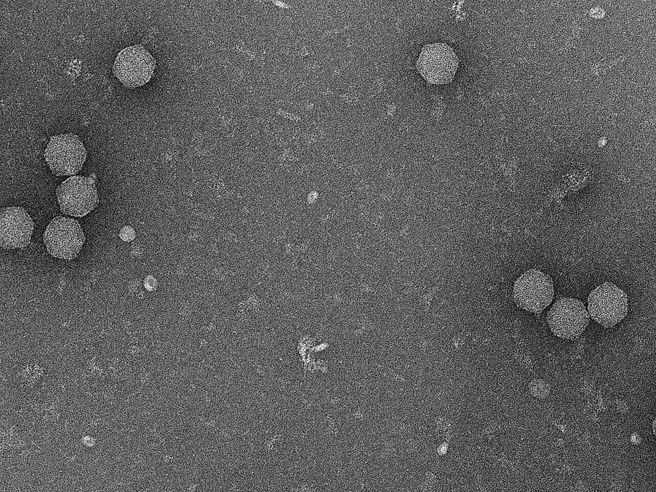 Electron micrograph of phage heads