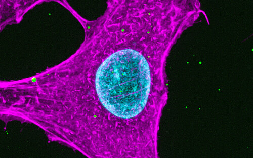 EM image
