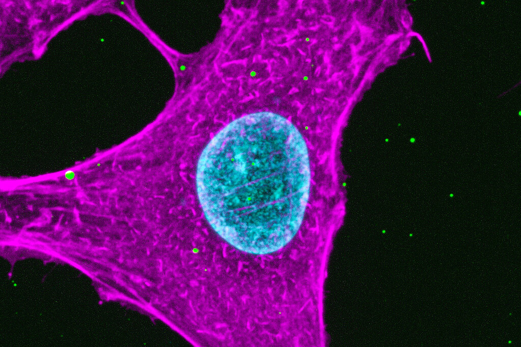 EM image