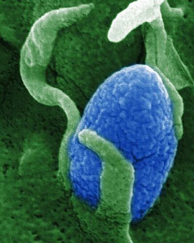 Invasion of bacteria in a cell