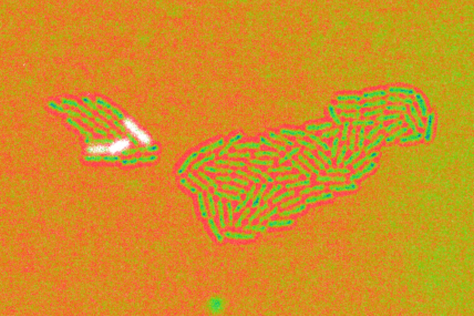 Zellen von Pseudomonas aeruginosa