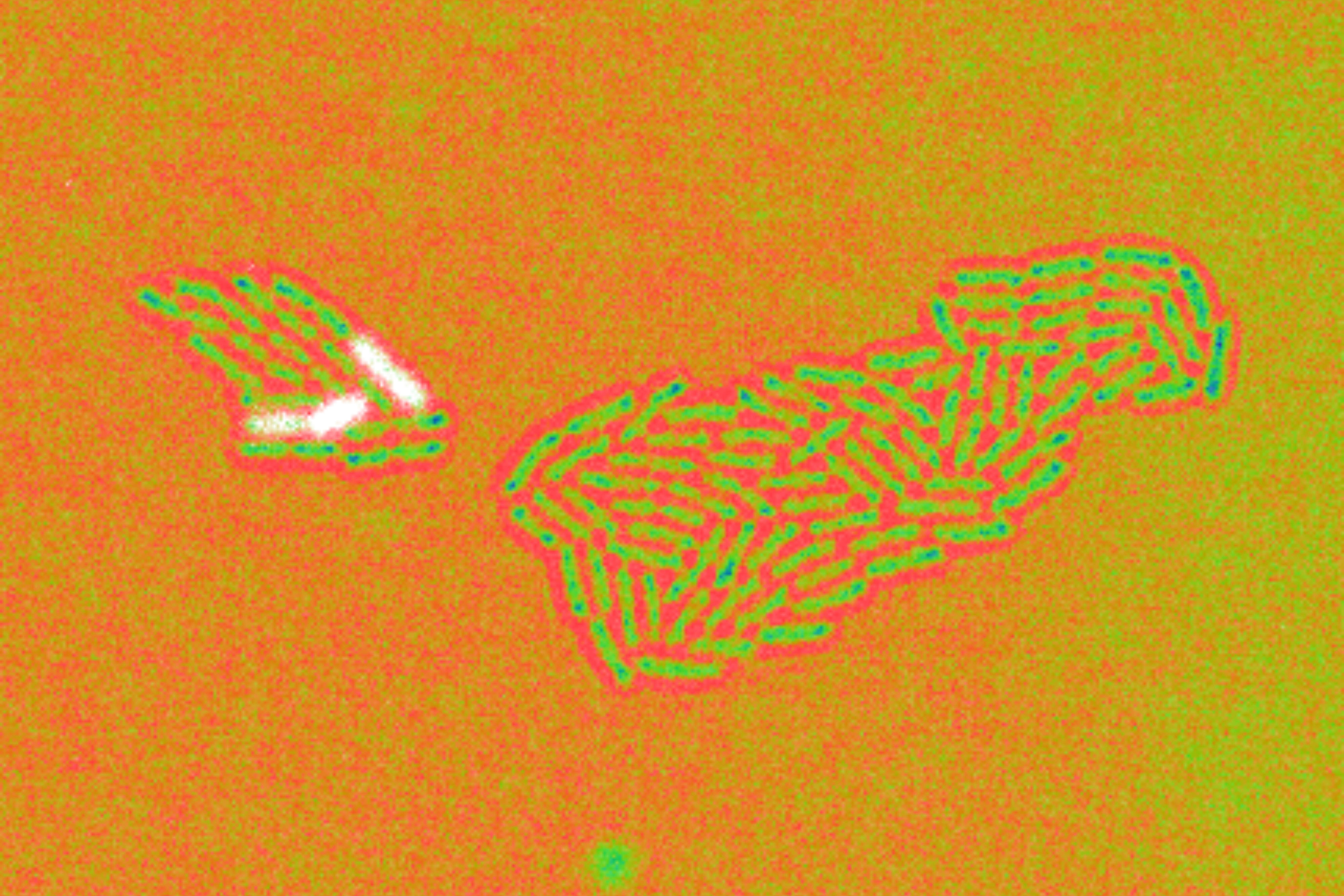 Zellen von Pseudomonas aeruginosa
