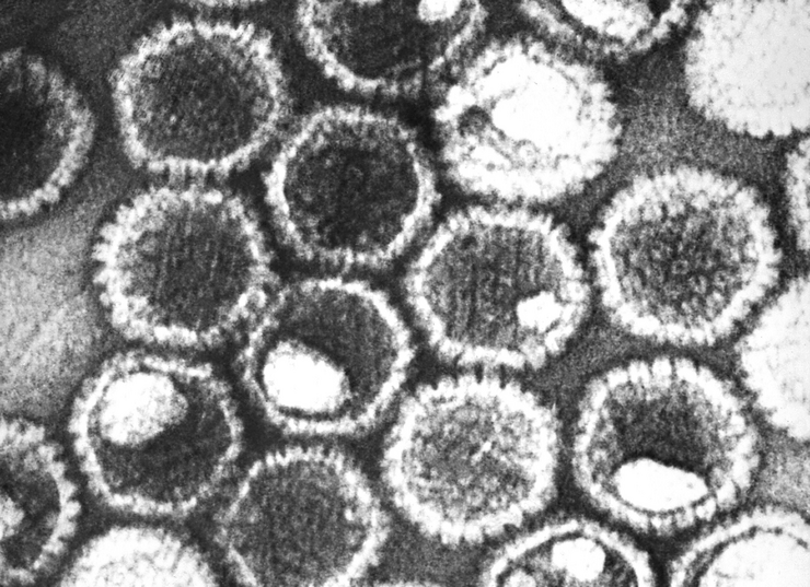Electron microscope image of herpes simplex viruses in black and white