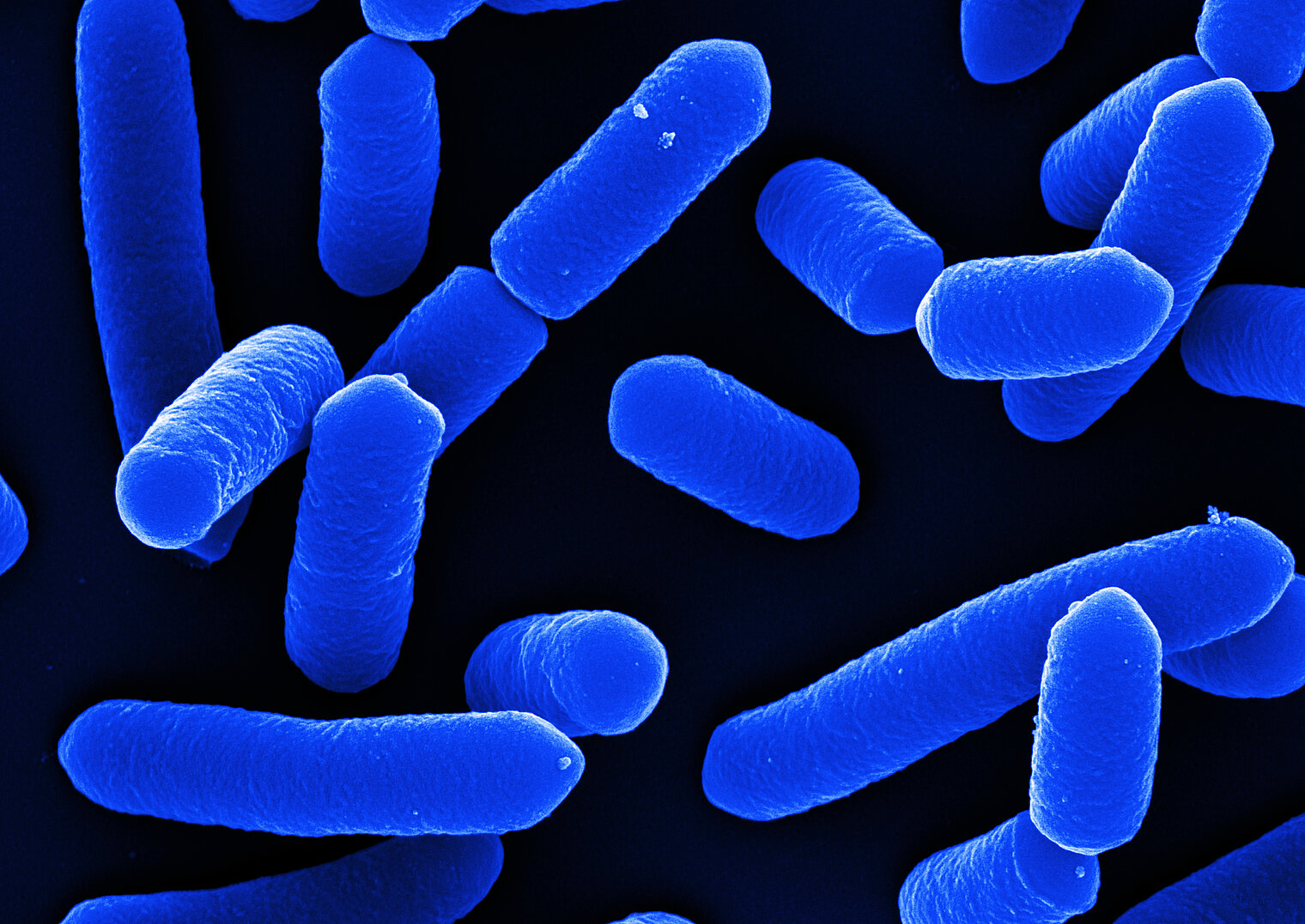 Elektronenmikroskopische Aufnahme von Listeria monocytogenes