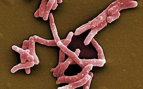  Scanning electron micrograph of Mycobacterium tuberculosis