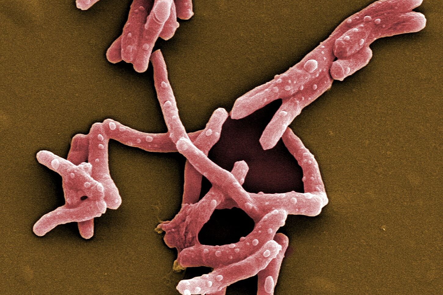  Scanning electron micrograph of Mycobacterium tuberculosis