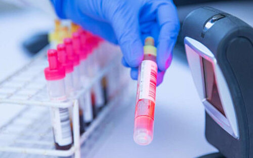 Blood samples