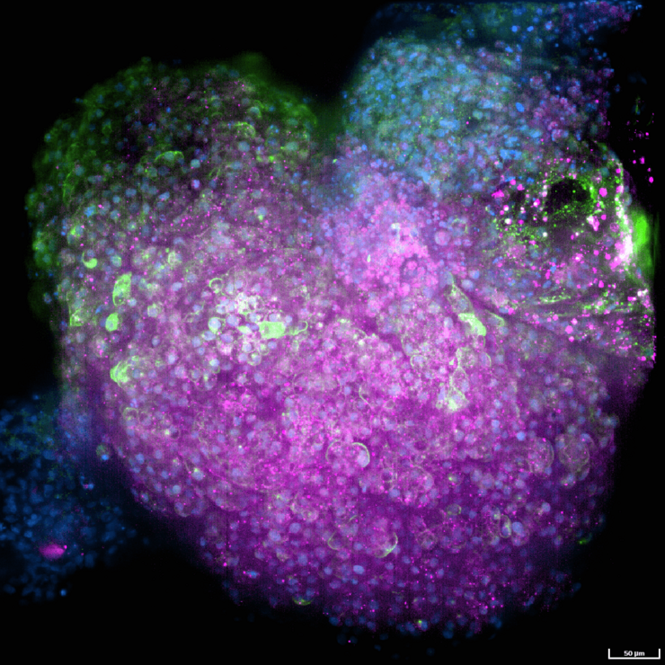 Fluorescence staining of a heart organoid. The cytoskeleton (tubulin) is stained in red, cell nuclei (DAPI) in blue and heart muscle cells (troponin) in green. 