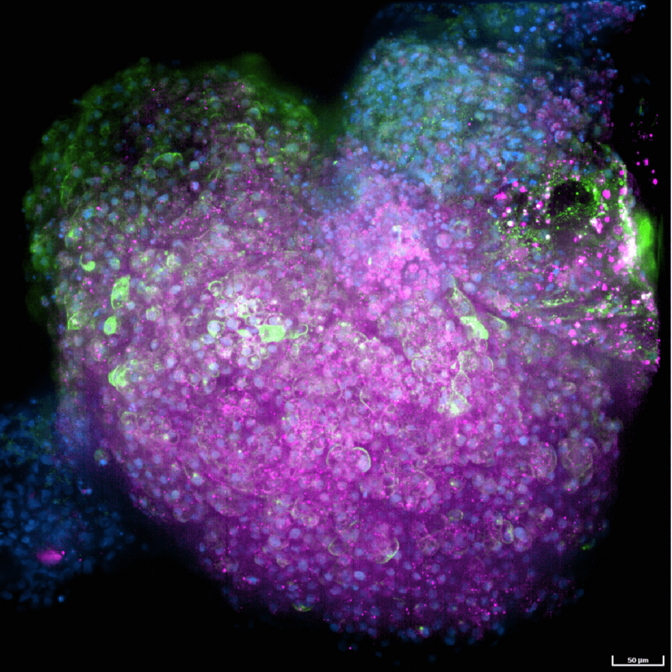 Fluoreszenzfärbung eines Herz-Organoids. Das Zellskelett (Tubulin) ist in rot gefärbt, Zellkerne (DAPI) in blau und Herzmuskelzellen (Troponin) in grün. 