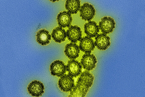 Elektronenmikroskopische Aufnahme von Viruspartikeln des Grippeerregers Influenza.