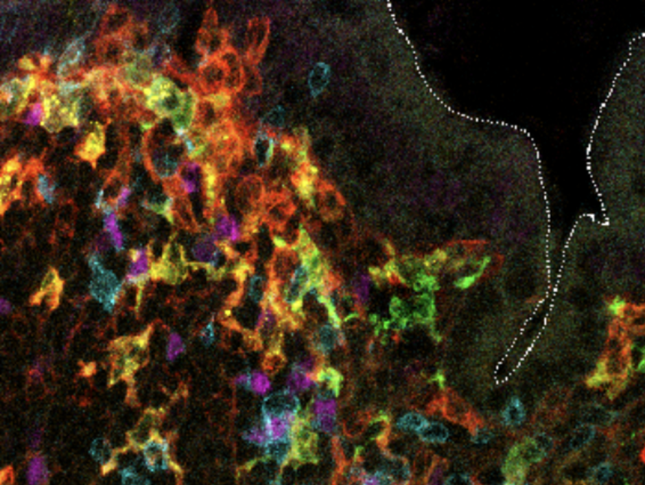 Neonatal dendritic cells in Peyer’s patches