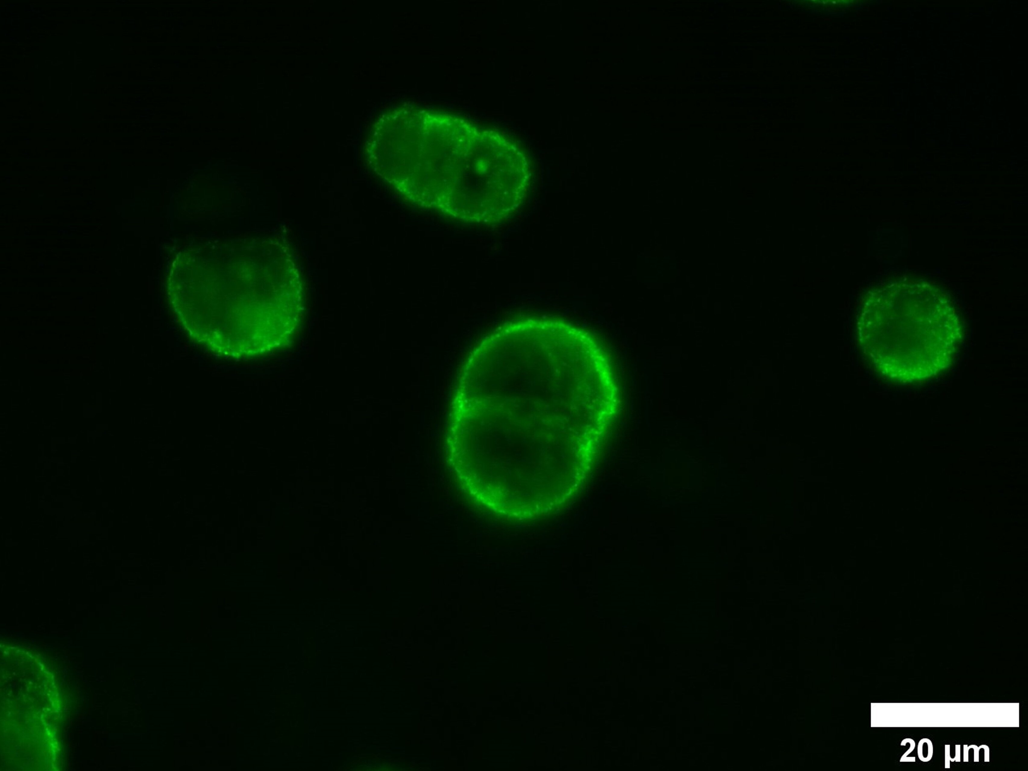 Messung des GFP-Signals von ACE2-produzierenden Expi293F-Zellen, die mit GFP-positiven SARS-CoV-2-VLPs inkubiert wurden
