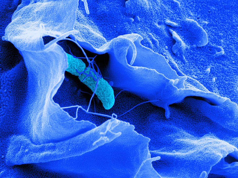 Electron micrograph of Salmonella typhimurium on a COS7 cell