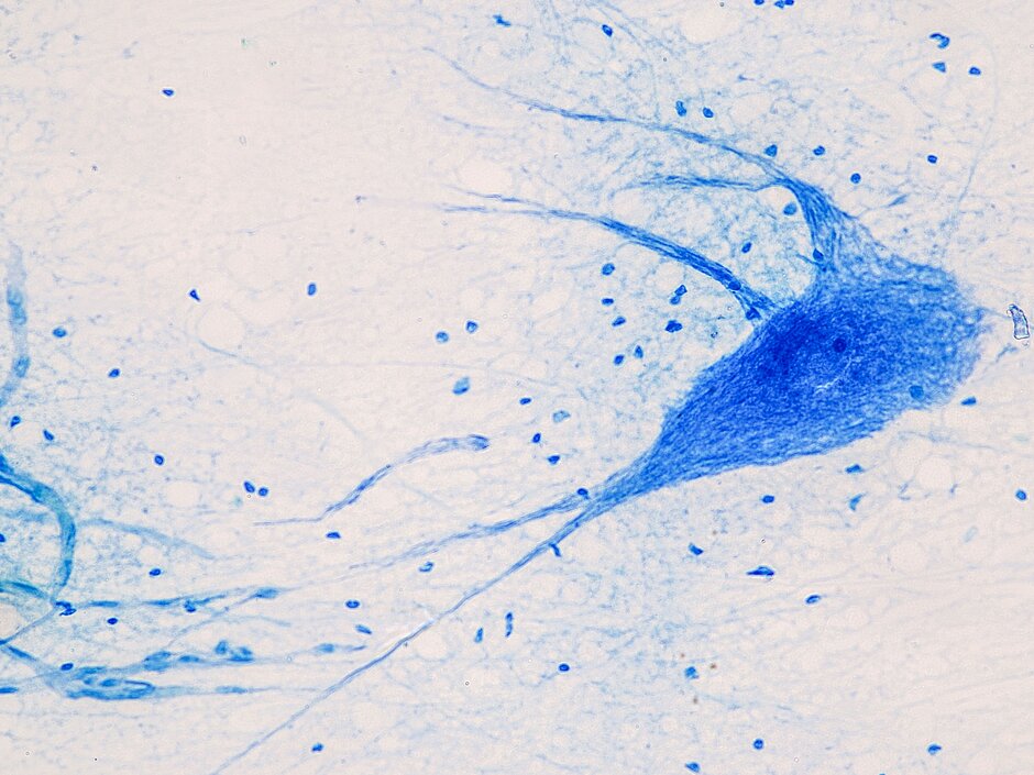 Education Spinal cord, Nerve, Cerebellum, Cortex and Motor Neuron Human under the microscope in Lab.