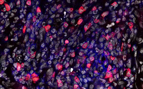 Mikroskopieaufnahme einer Infektionsstelle von Leishmania major in der Haut