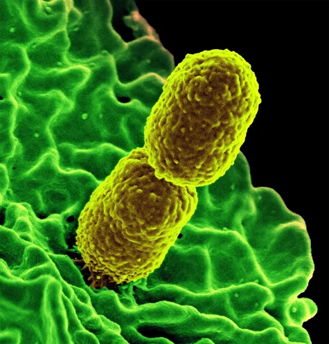 Klebsiella bacteria micrograph