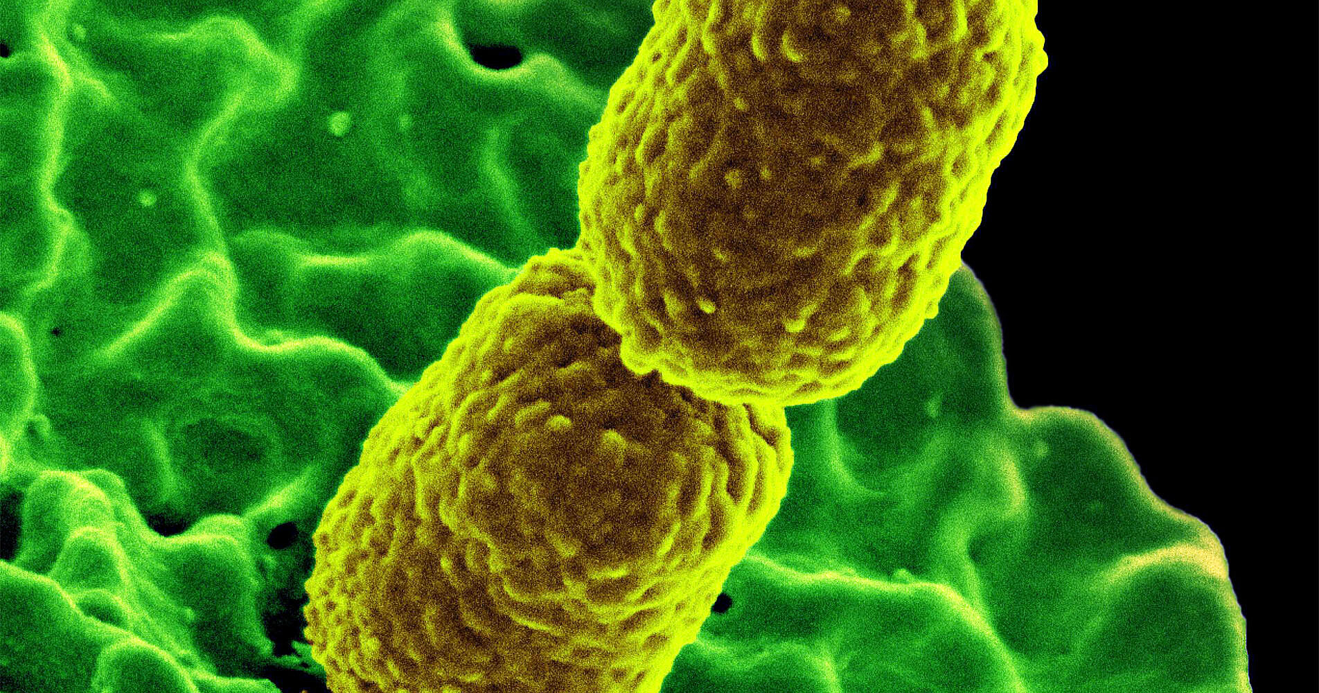 HZI Klebsiella