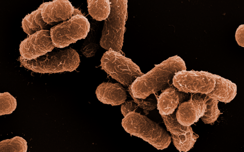 Elektronenmikroskopische Aufnahme von Klebsiella oxytoca 