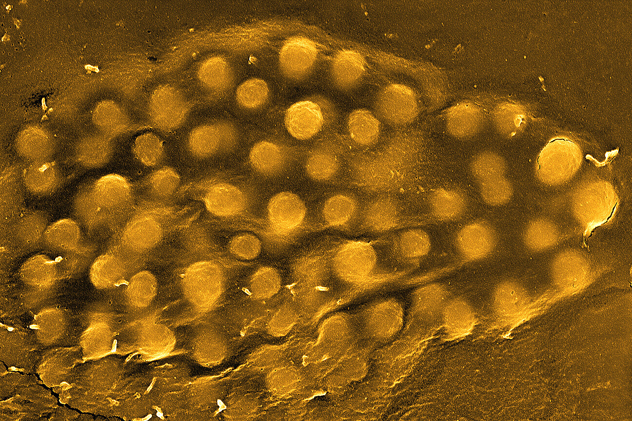 Electron microscope image