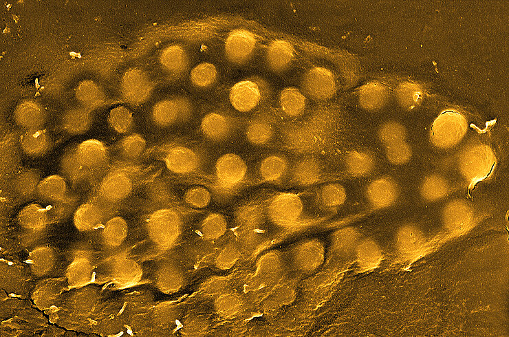 Electron micrograph of Staphylococcus aureus, stained in yellow