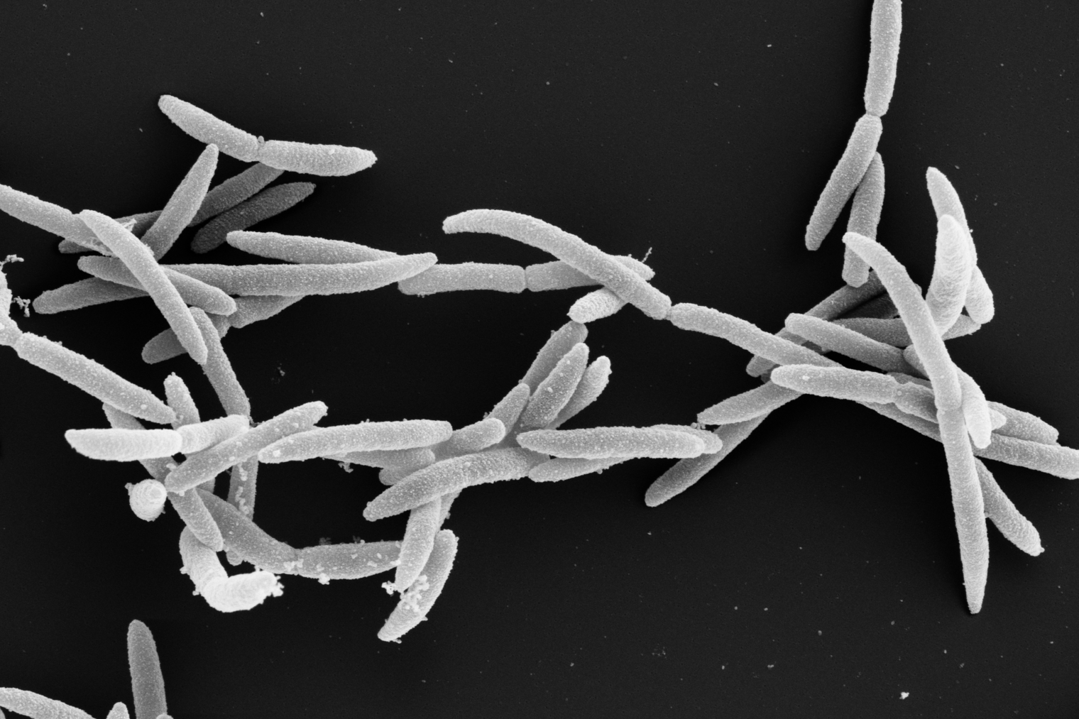 Electron microscope image of Fusobacteria.