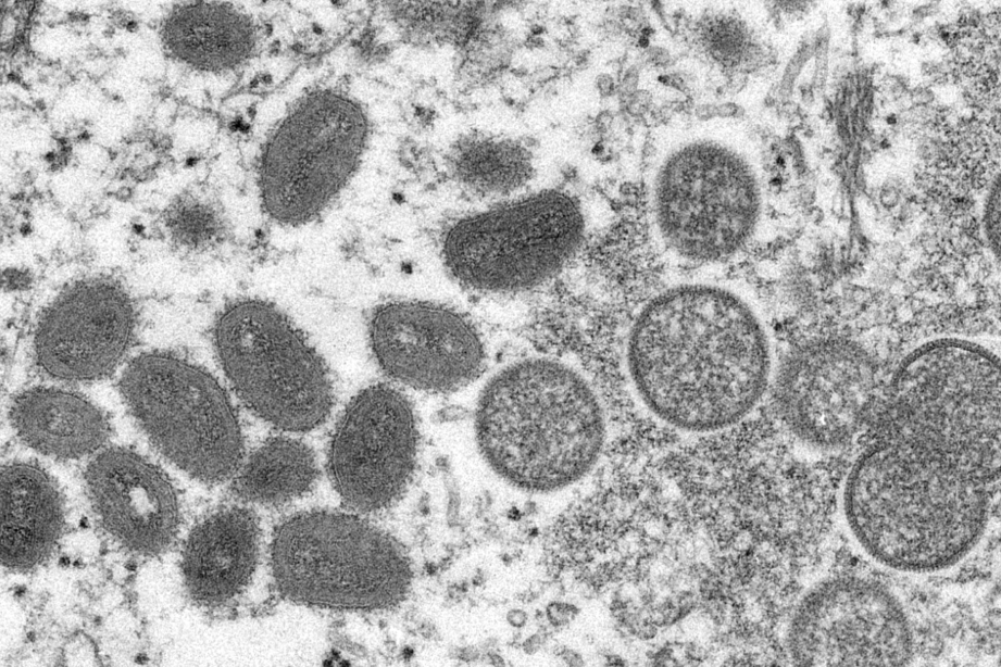 Elektronenmikroskopische Aufnahme Mpox-Virus