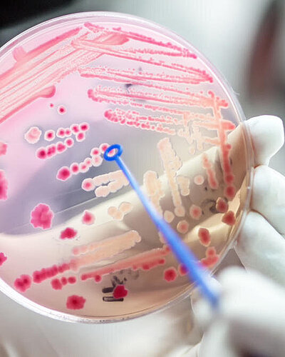 Agar plate with streaked bacteria