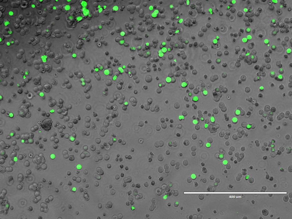 Grün fluoreszierende Zellen