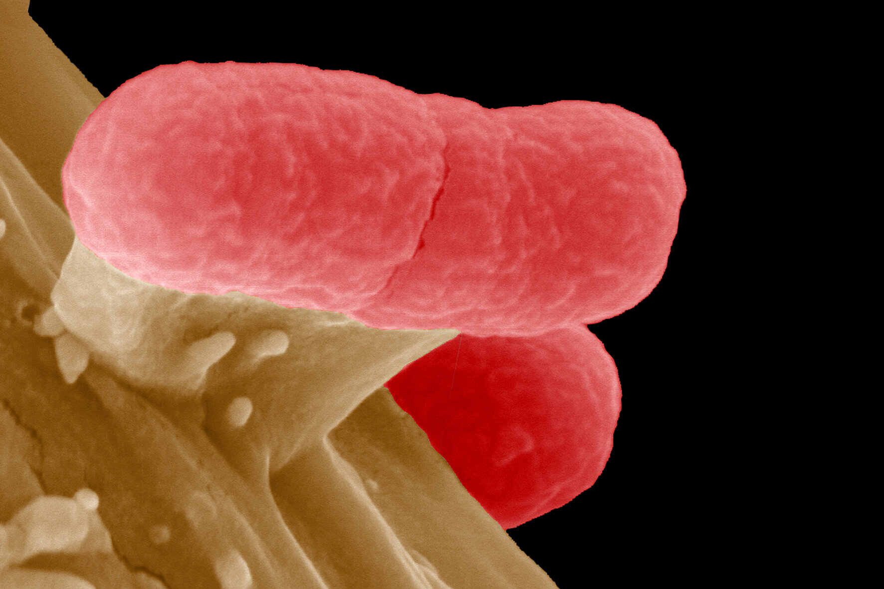 EHEC-Bakterien auf einer Darmzelle