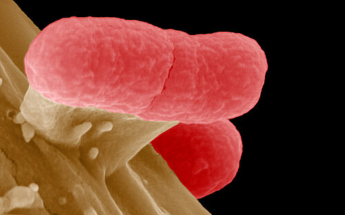 EHEC bacteria on an intestinal cell