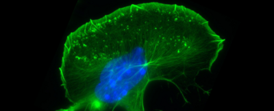 Aktinzytoskelett einer migrierenden Zelle mit Zellkern 