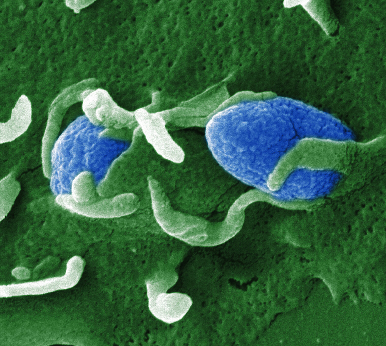 Invasion of Yersinia enterocolytica in cells