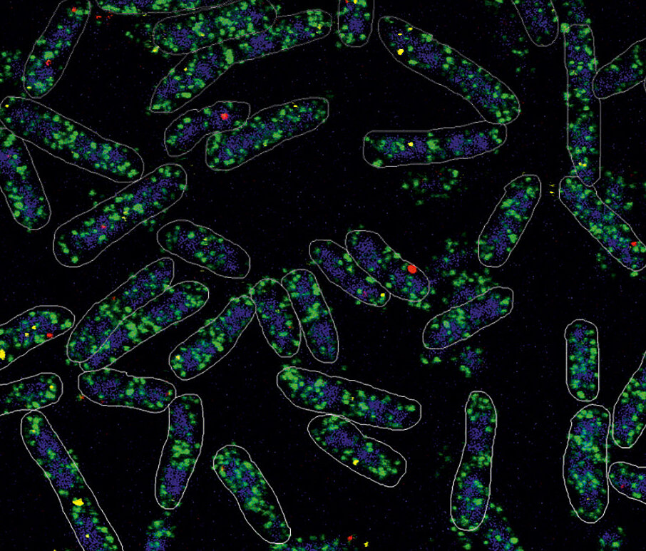 Microscopic image of rod-shaped bacteria with green-blue and red spots on a black background
