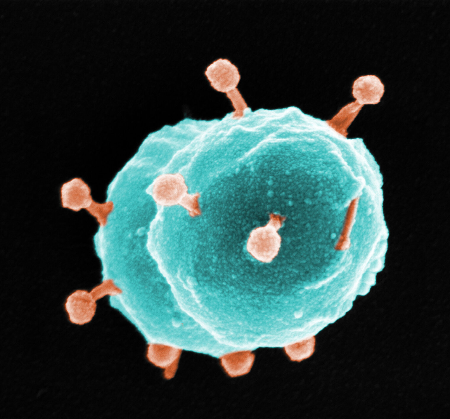 Rasterelektronenmikroskopische Aufnahme einer Enterococcus faecium-Zelle (hellblau), die von Bakteriophagen (rot) infiziert wird