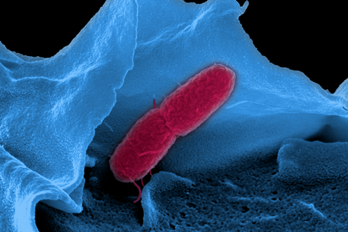 Salmonella on a cell