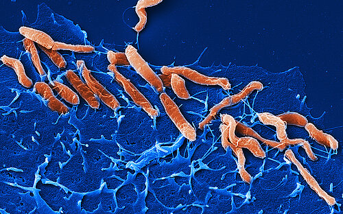 Helicobacter pylori, a pathogen residing in the stomach, is the cause of the most common chronic bacterial infection. ©HZI/Rohde