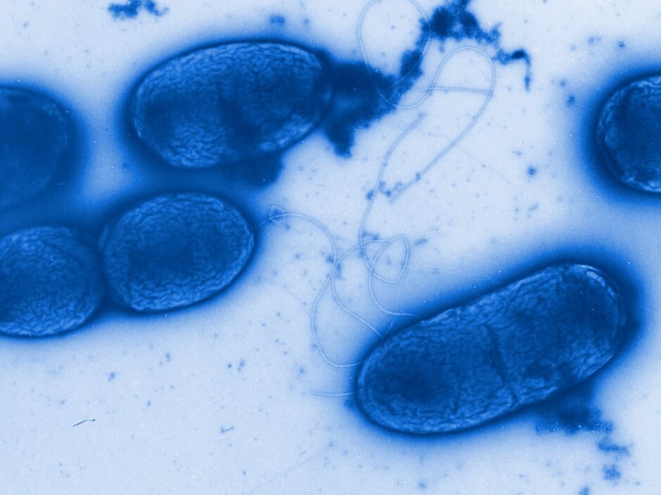Picture of P.aeruginosa