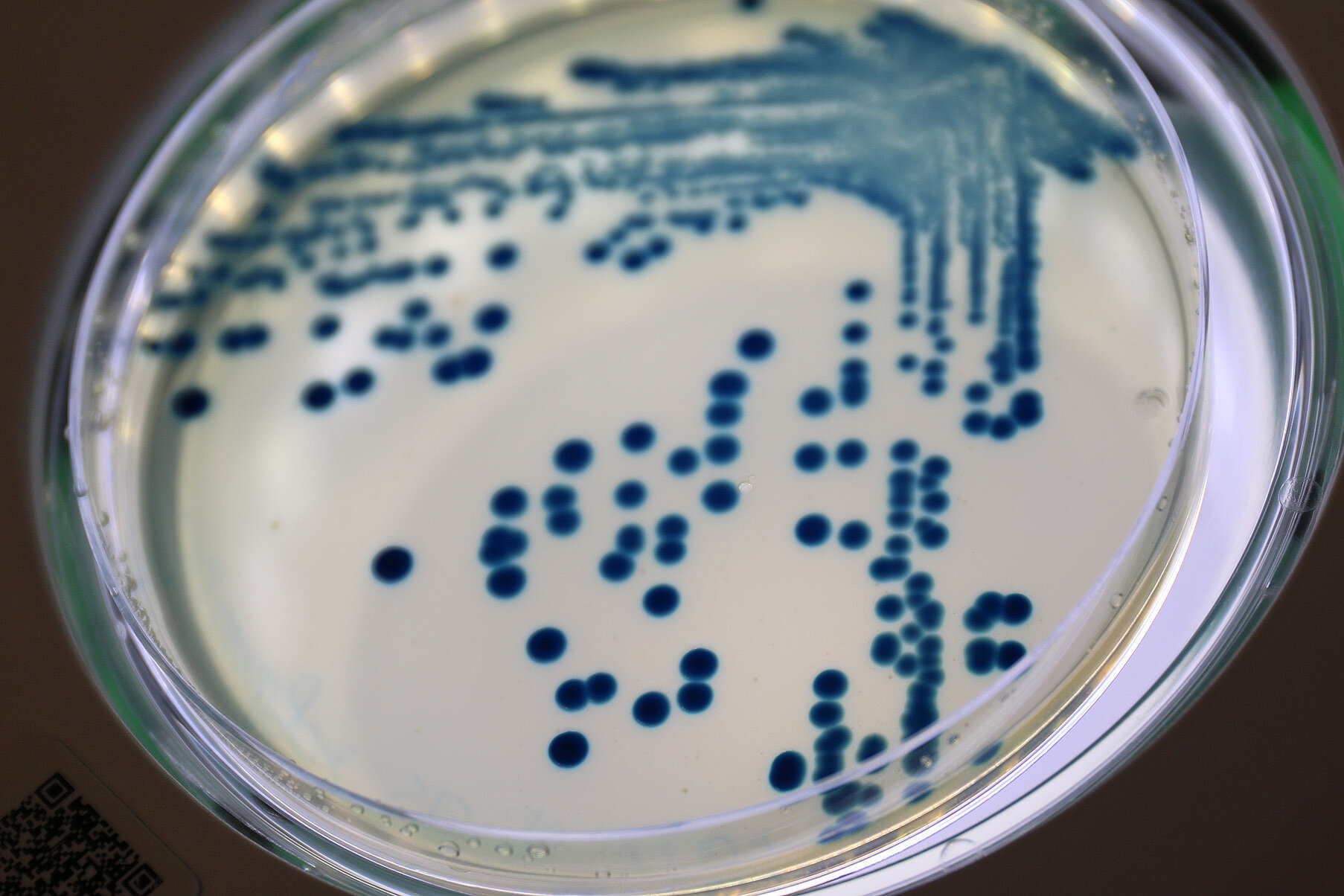 Punktförmige Kolonien des Bakteriums Klebsiella pneumoniae (blau) auf einer runden Nährbodenplatte