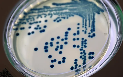 Wenn Resistenz mit Virulenz einhergeht