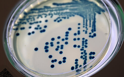 Dot-like colonies of the bacterium Klebsiella pneumoniae (blue) on a round plate