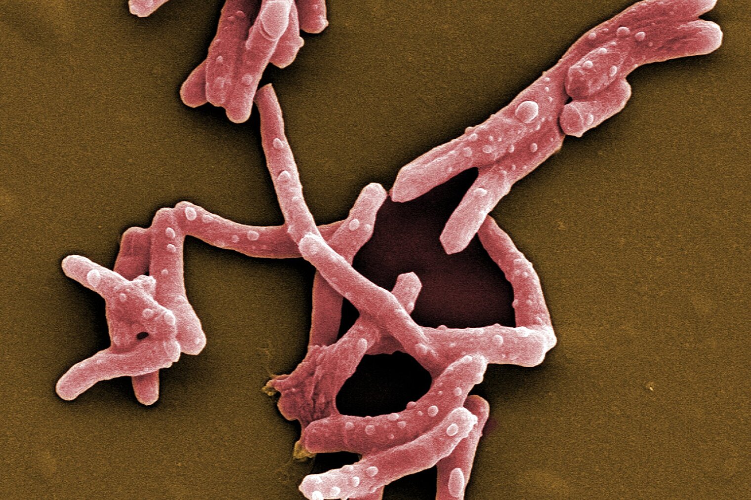 Rasterelektronenmikroskopische Aufnahme von Mycobacterium tuberculosis.