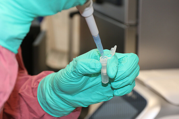 Zwei Hände mit blauen Handschuhen und einer Pipette 