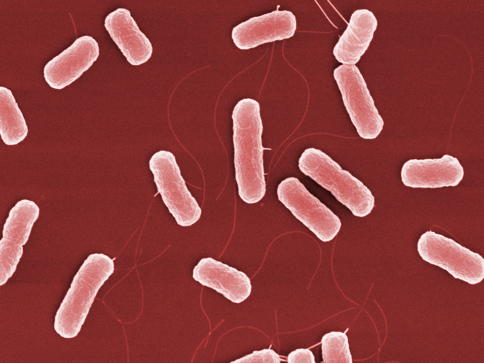 Elektronenmikroskopische Aufnahme von Escherichia coli 