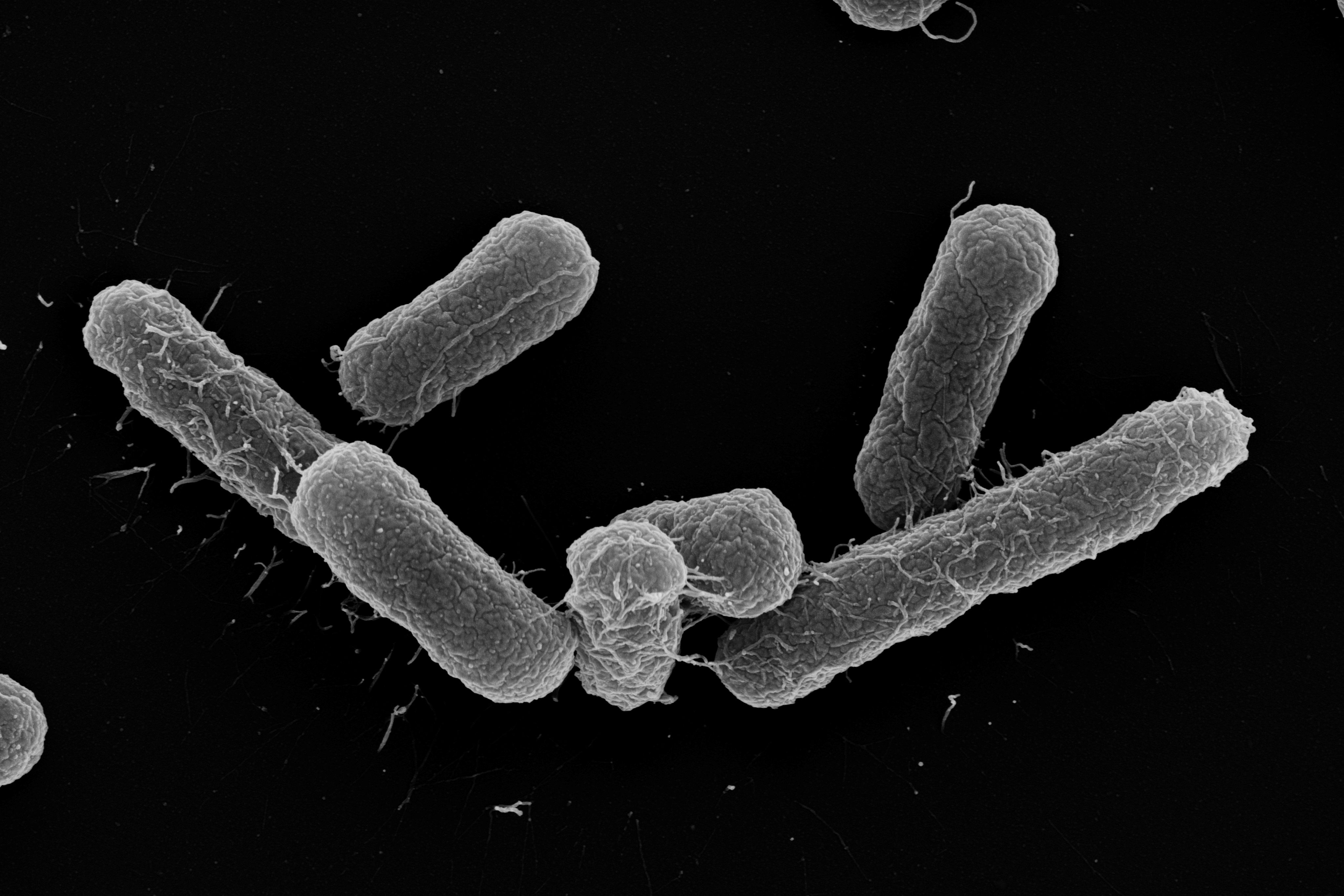 Escherichia Coli Electron Microscope
