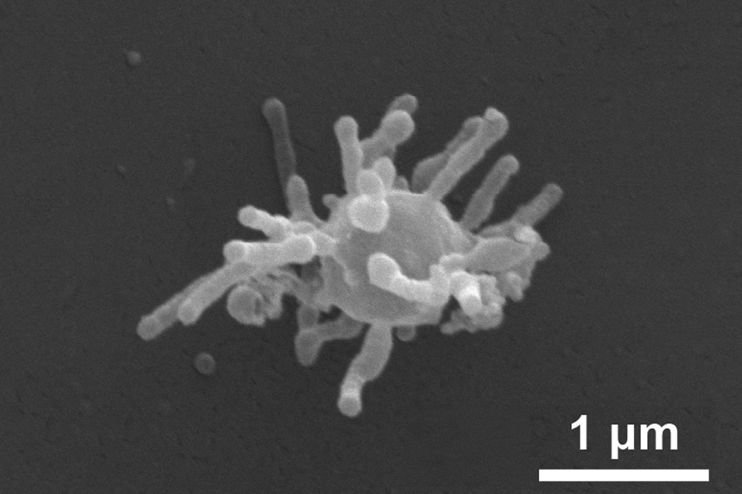 micrograph of an Asgard archaea cell