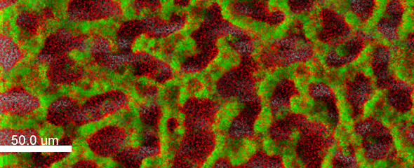 Biofilm eines klinischen Isolates von Pseudomonas aeruginosa 