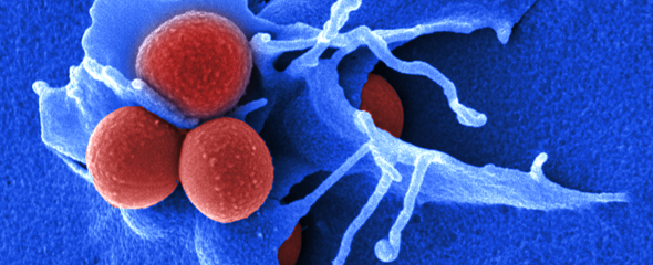 Elektronenmikroskopische Aufnahme von Staphylococcus aureus