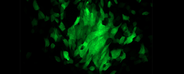 Mit HCMV infizierte Epithelzellen unter dem Fluoreszenzmikroskop. 