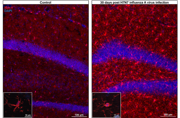 Gefräßige Mikrogliazellen (in rot): Wenn die Immunzellen des Gehirns überreagieren, verschlingen sie auch Teile von Nervenzellen. 
