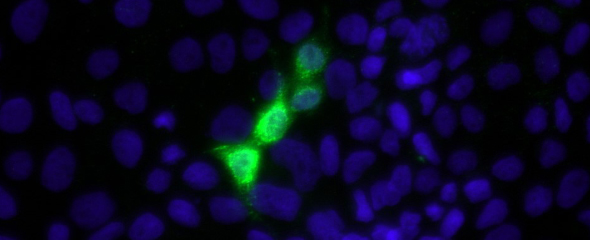 Die grüne Immunfärbung des Hepatitis E Virus Kapsidproteins in den Plazentazellen weist die Replikation des Virus in diesen nach. 